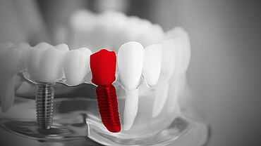 Diş endüstrisi için ZwickRoell test sistemleri