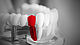 ZwickRoell testing systems for the dental industry